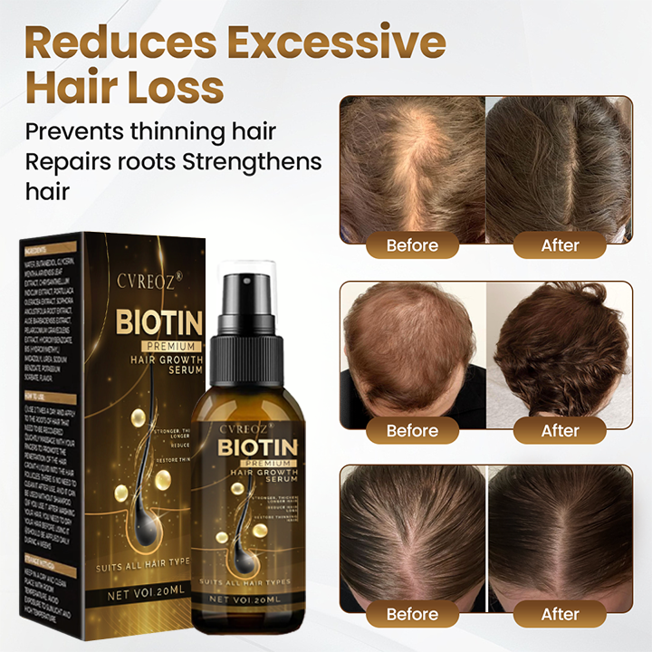 Cvreoz® Biotin Premium Hair Booster - Proven and Tested by Experts! 👩‍⚕️